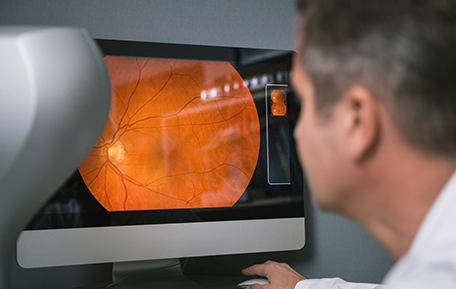 Choosing the Right CRO in Ophthalmic Clinical Trials